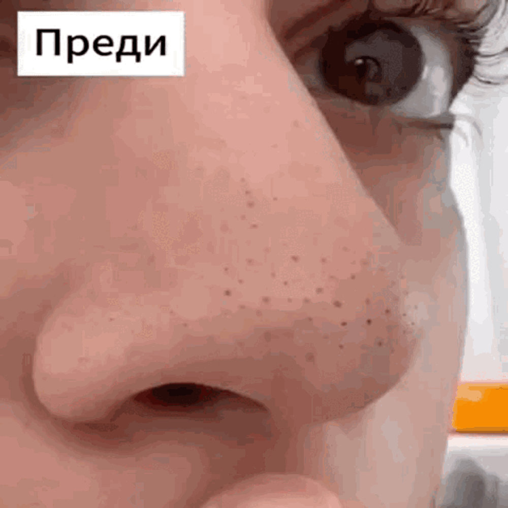 GLOWL Ленти за дълбоко почистване на порите