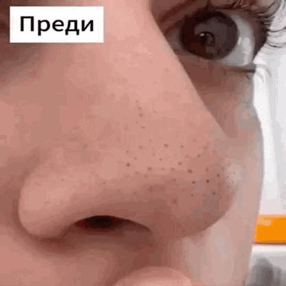 GLOWL Ленти за дълбоко почистване на порите